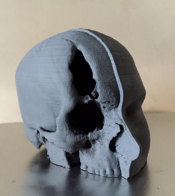 Dissected Head / Skull MRI Scan