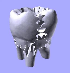geared tooth   