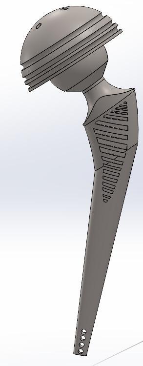 Hip prosthesis