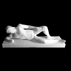 Fallen Warrior- Temple of Aphaia