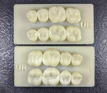 Dental model for practicing and occlusal modeling