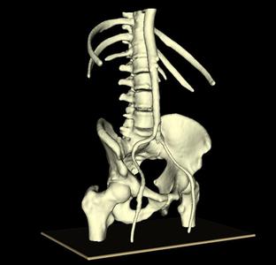 Pelvic-Abdominal Vascular Model (PAVM)
