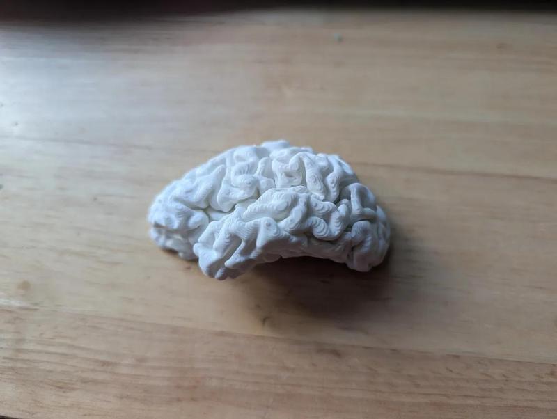 Brain in Parts plus Magnets   