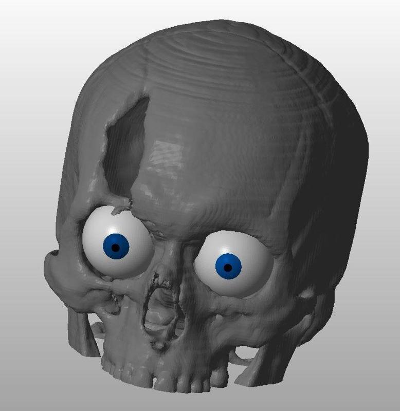 CSI style Skull created from CT scan images