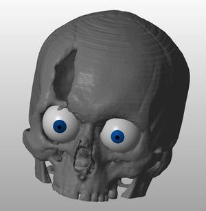 CSI style Skull created from CT scan images