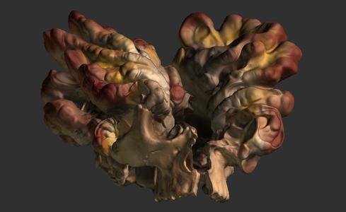 Deformed Skull