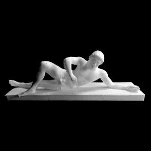 Dying Warrior- Temple of Aphaia