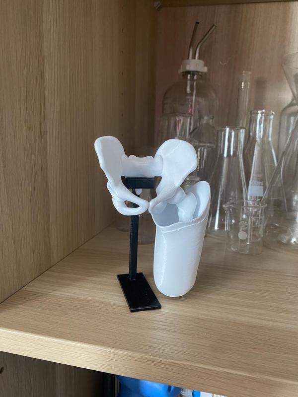 pelvis transfemoral socket IC