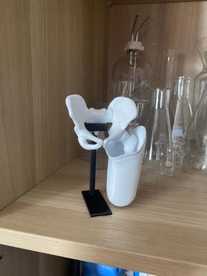 pelvis transfemoral socket IC