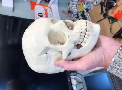Human skull