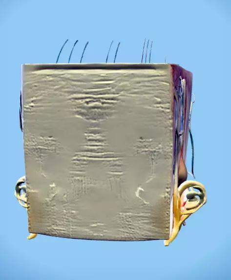 cross section of humman skin with hair folicles