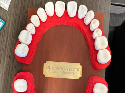 Full Mouth Teeth Clickers