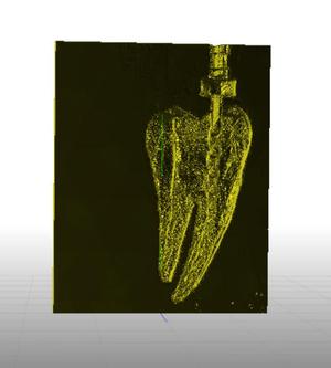 decorative painting endodontics
