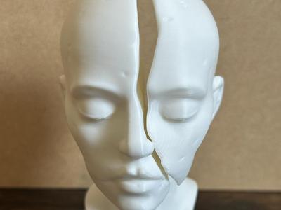 Lady With Splitting Headache (Literally)