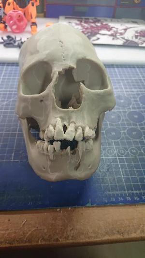Human-Skull   