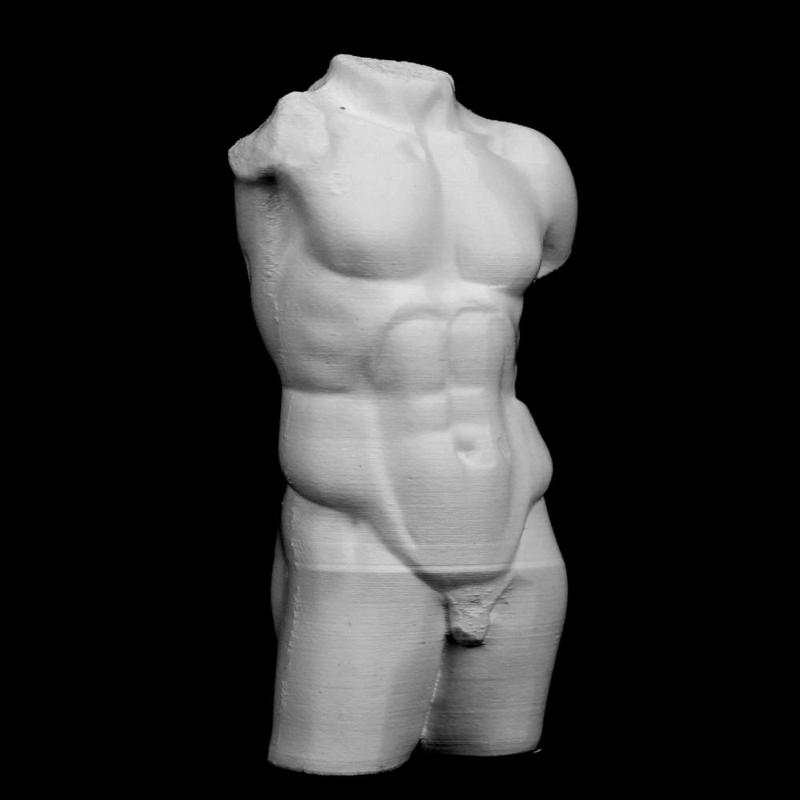 Fragment of Diadumenos at The Réunion des Musées Nationaux, Paris