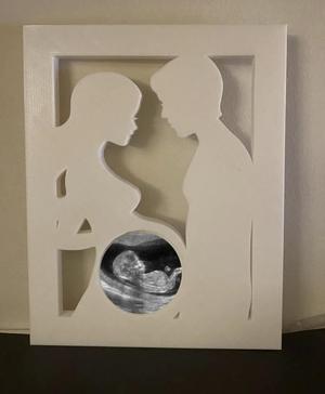 Ultrasound baby couple baby picture