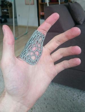 Index Finger Splint