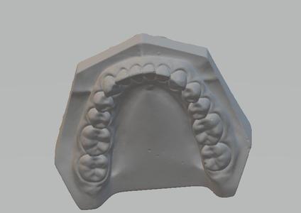 Dental Model - Scanned by Creality Scanner Otter