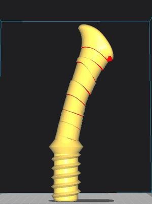 Remix with Ventress LS