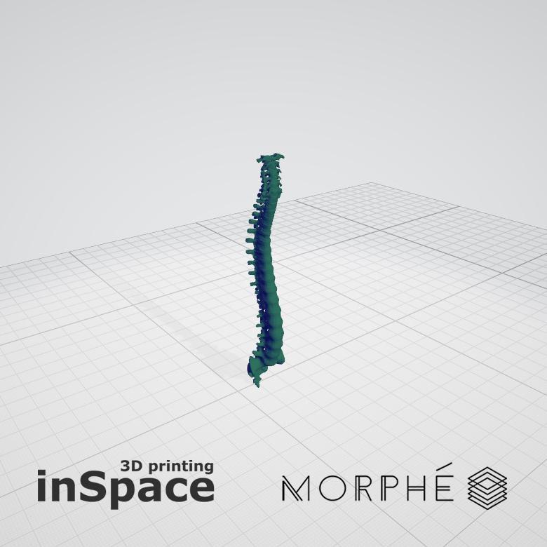 Medical - Vertebrae (solid) - Real size