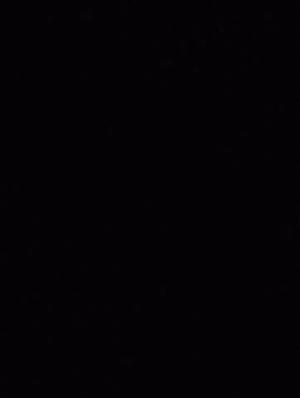 Redmi note 11 phone case   