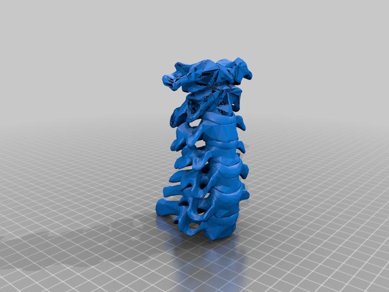 Cervical vertebrae