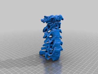 Cervical vertebrae