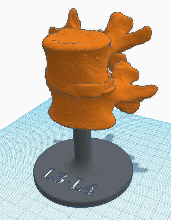 L3-L4 SPINAL MODEL