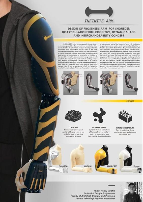CRE-012 Infinite Arm - Low-Cost Prosthetic Arm for Shoulder Disarticulation - iDIG (Integrated Digital Design Laboratory), Department of Industrial Design ITS Indonesia