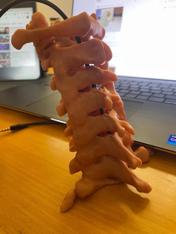 Cervical spine (c1 to c7)