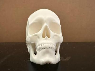 Skull