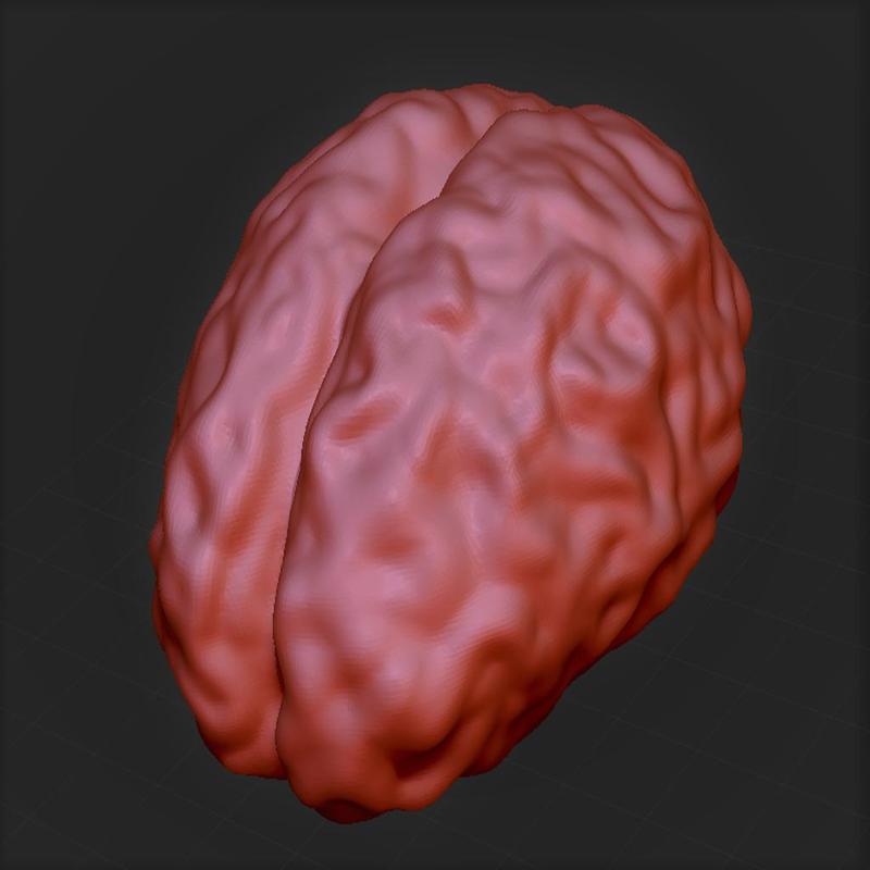 Brain 