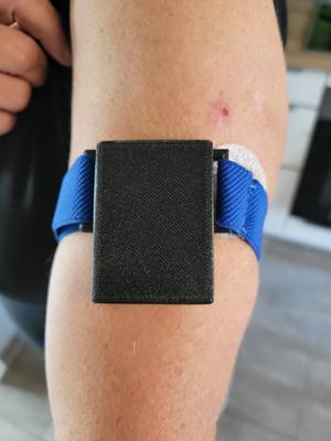 Kaleido Insulin Pump fixation