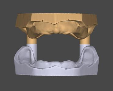 model for trying on prosthetics