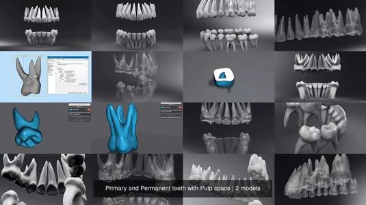 Primary and Permanent teeth with Pulp space 3D Model Collection