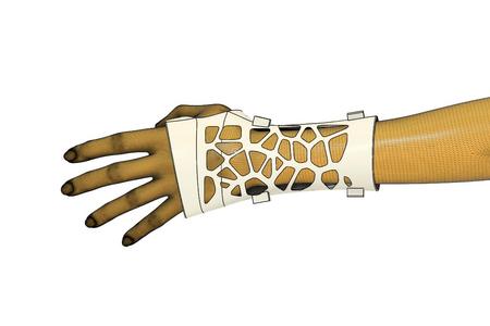 Wrist splint