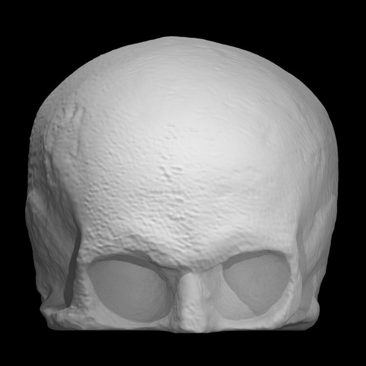 Skull Cast of Robert Burns