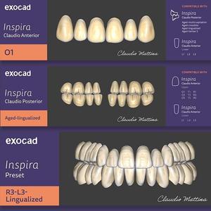 exocad prosthetic tooth presets formdv