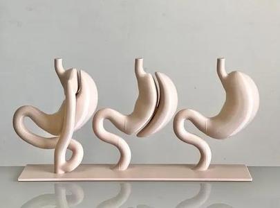 Bariatric surgical procedures