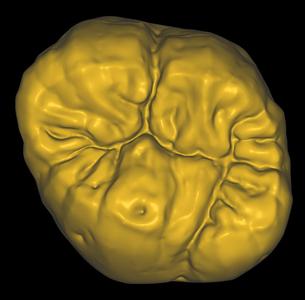 Maxillary Molar Sculpt Free STL