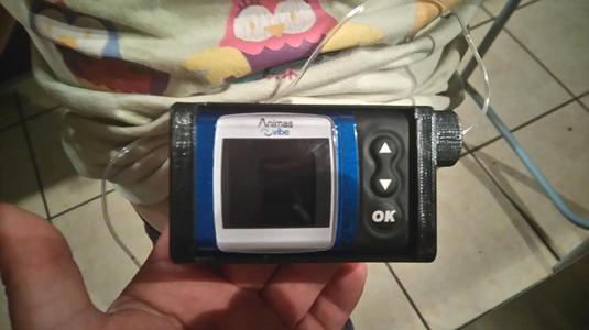 Coque pour pompe Animas Vibe - Case for insulin pomp (v2)