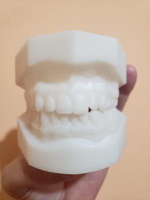 Complete Denture