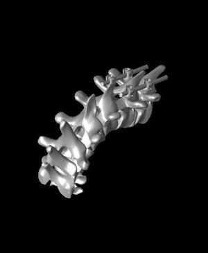 PJK cervicothoracic junction bennett render