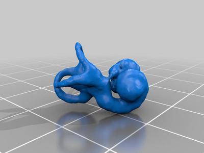 Cochlea and Semicircular Canals