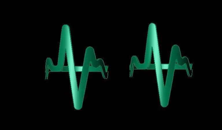 Elegant ECG Heartbeat Ring Band 1gm