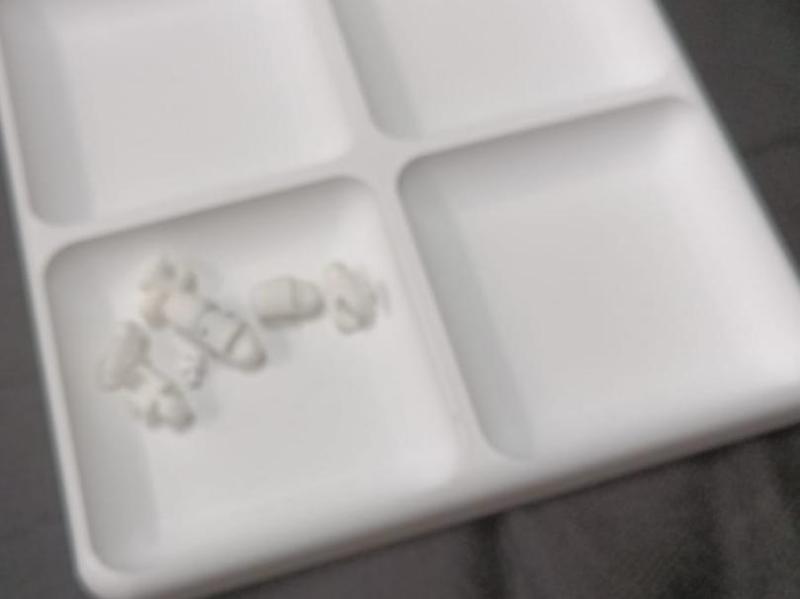 You're missing a screw