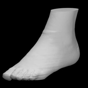 Skin surface of a foot