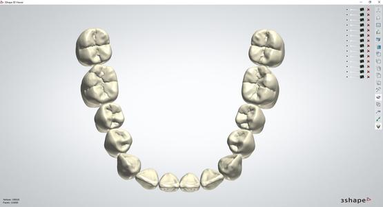 3Shape OPEN Library AP_Exo_G3