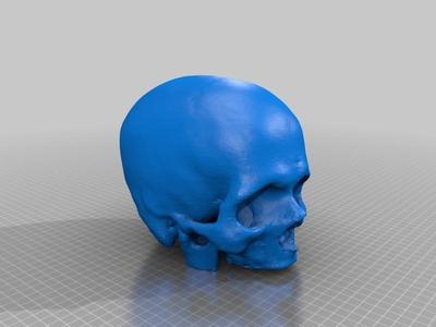 Cleaned Skull